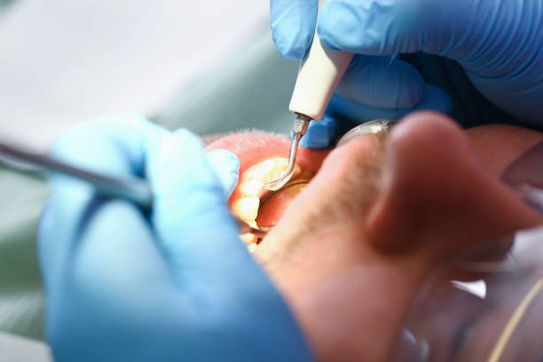 Best Pediatric Emergency Dentist in Bermuda Dunes, CA