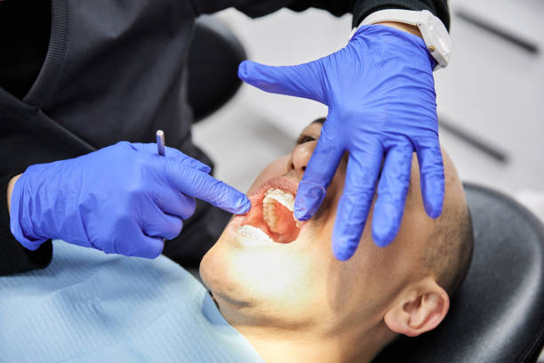 Best Urgent Care for Lost Fillings or Crowns in Bermuda Dunes, CA